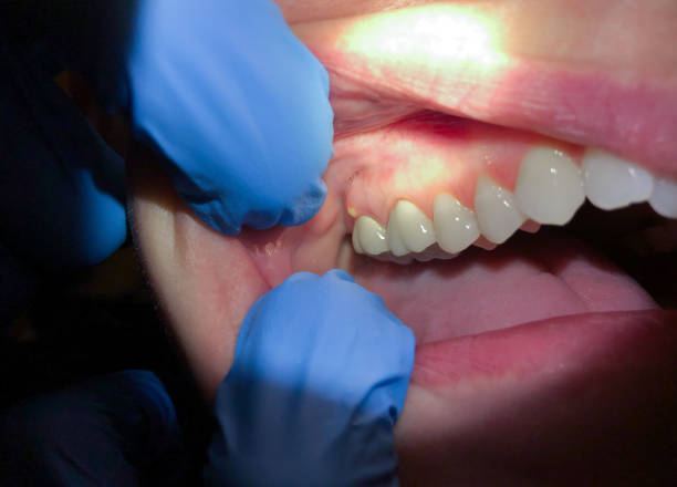 Best Mobile Emergency Dentist in Stuarts Draft, VA