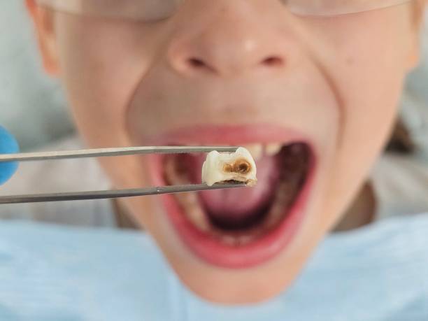 Best Holiday Emergency Dentist in Stuarts Draft, VA