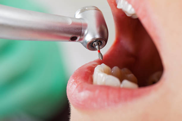 Best Emergency Dental Extractions in Stuarts Draft, VA